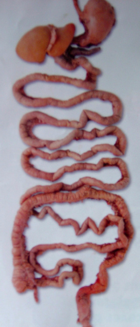 body worlds intestines